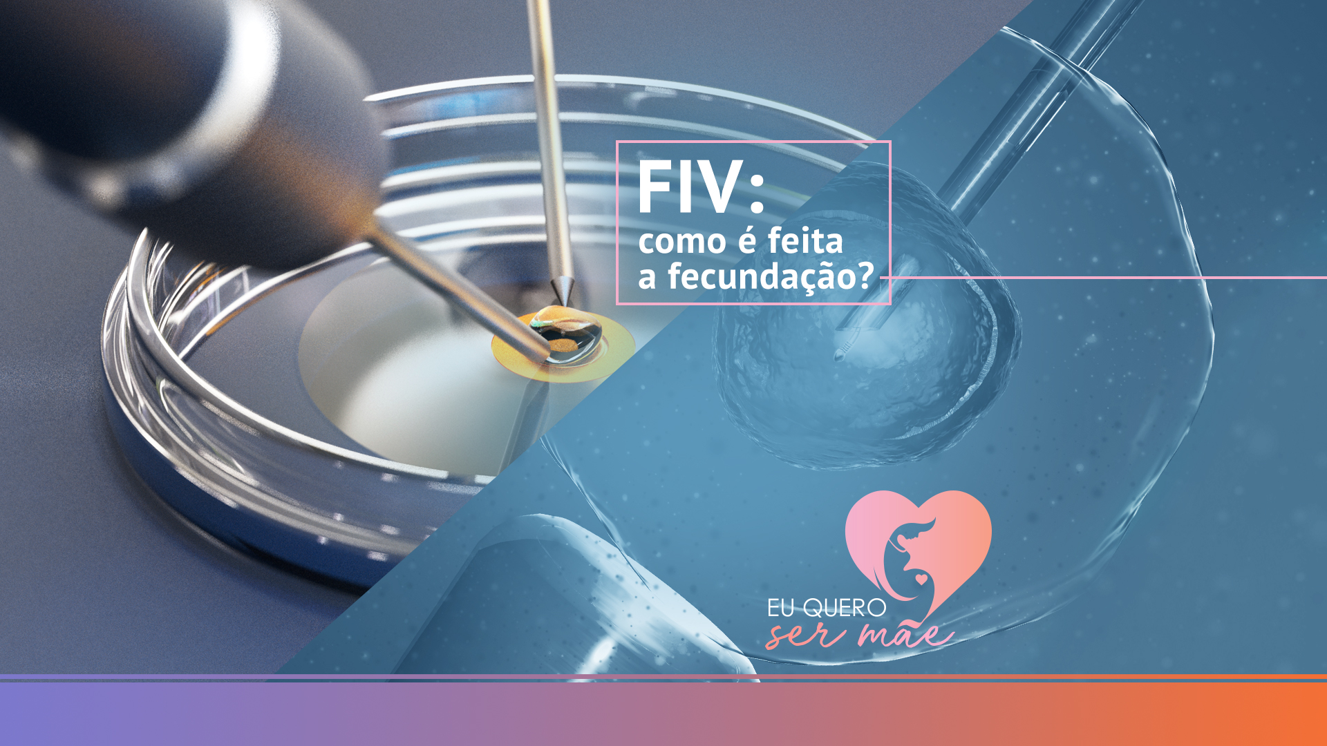 FIV: como é feita a fecundação?